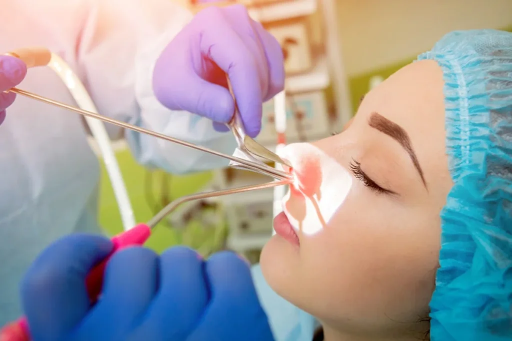 Endoskopik sinüs cerrahisi